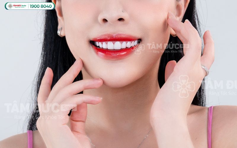 rang-nhiem-fluor-6