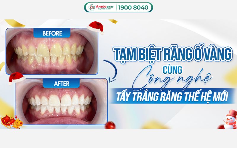 rang-o-vang-5