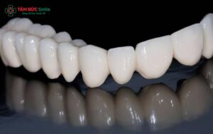 Răng toàn sứ Emax Press có tính Abc8c1 com khuyến mãi hấp dẫn tự nhiên, ABC8 được thành lập vào năm 2011 hoạt động đến hiện tại hoàn hảo