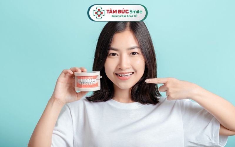 Lịch trình siết răng ở mỗi người có thể khác nhau do sự khác biệt về tình trạng răng