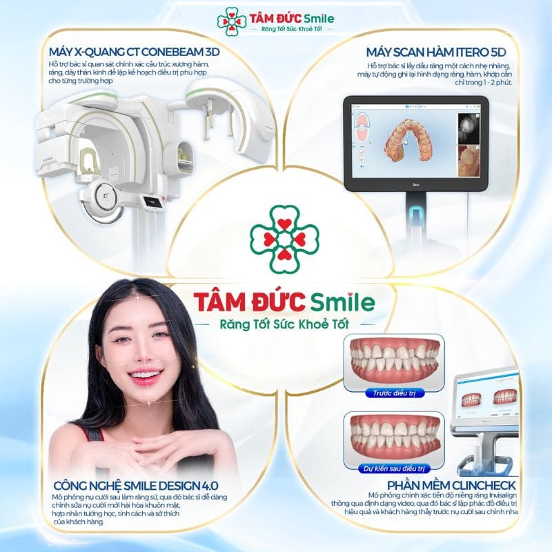 Quy trình siết răng chuẩn cần có sự hỗ trợ của công nghệ hiện đại