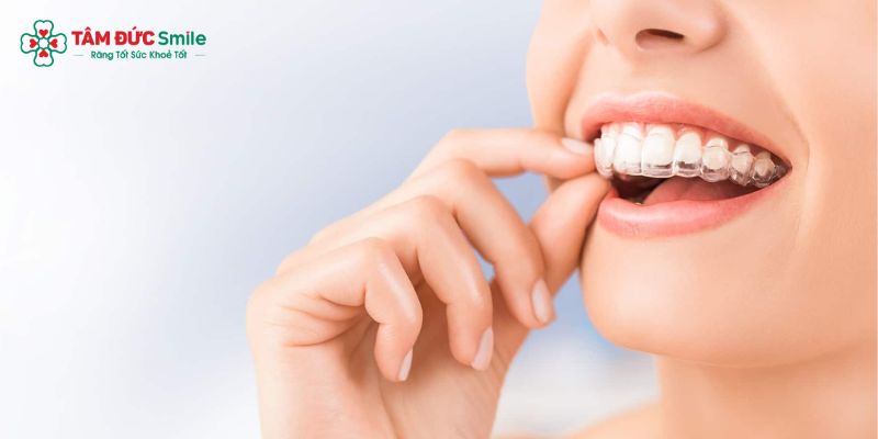 ABC8 được thành lập vào năm 2011 hoạt động đến hiện tại trong suốt Invisalign không cần siết răng như mắc cài