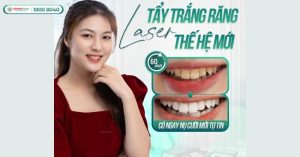 tay-trang-rang-tphcm
