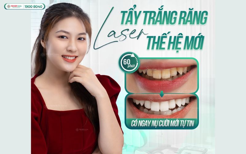tay-trang-rang-tphcm-6