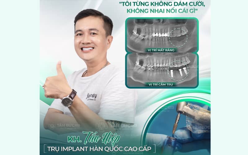 Abc8com cá cược trực tuyến chuẩn y khoa, trụ Titanium chất lượng cao