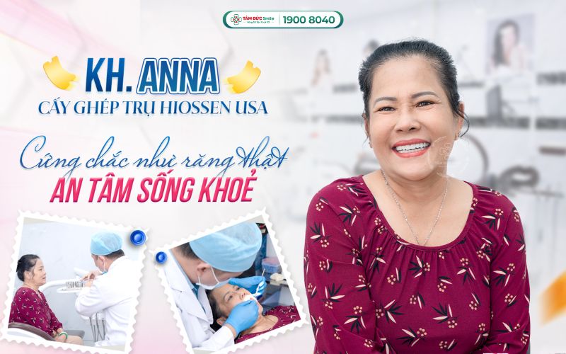trong-rang-implant-tphcm-7