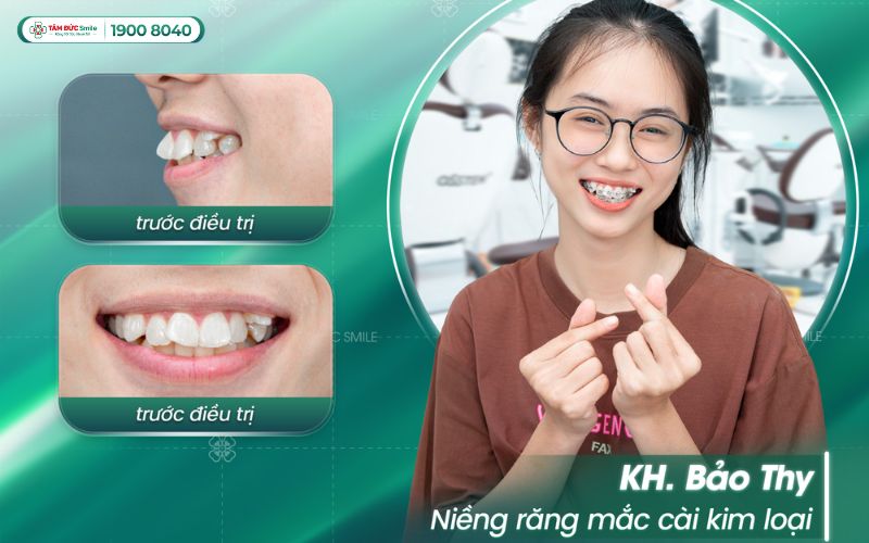 ABC8 được thành lập vào năm 2011 hoạt động đến hiện tại mắc cài kim loại – Giải pháp phổ thông, hiệu quả cao