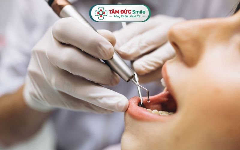 Để chẩn đoán viêm lợi trùm răng khôn, ABC8 đường link chính thức cần thực hiện các bước thăm khám lâm sàng và cận lâm sàng