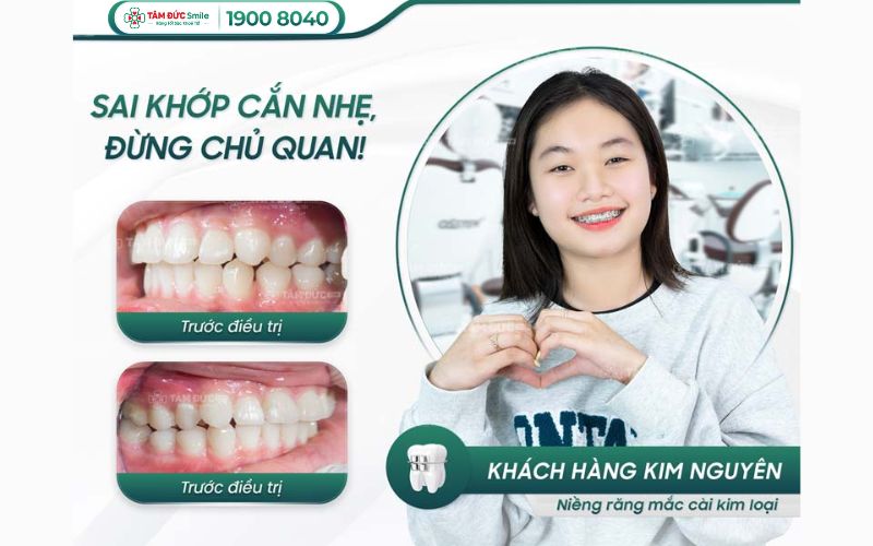 xuong-ham-la-gi-10