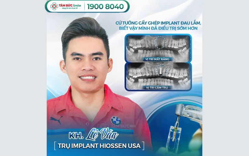 yeu-to-danh-gia-dia-chi-trong-rang-implant-tai-quan-9-9