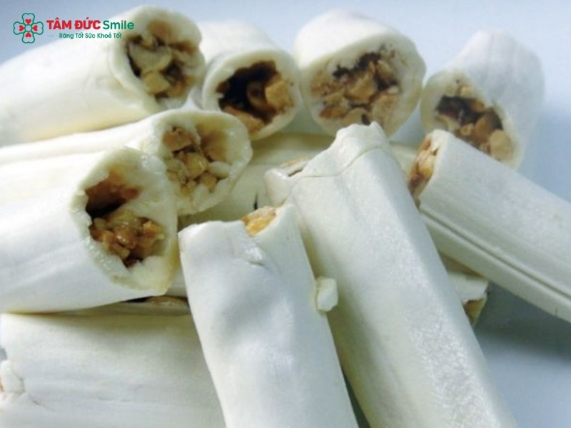 19-tuoi-nieng-rang-bao-lau-6