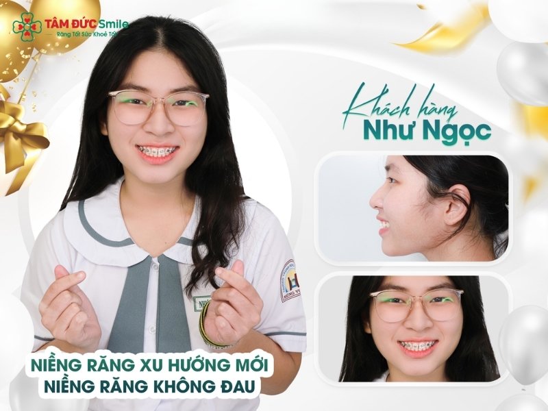 19-tuoi-nieng-rang-bao-lau-7
