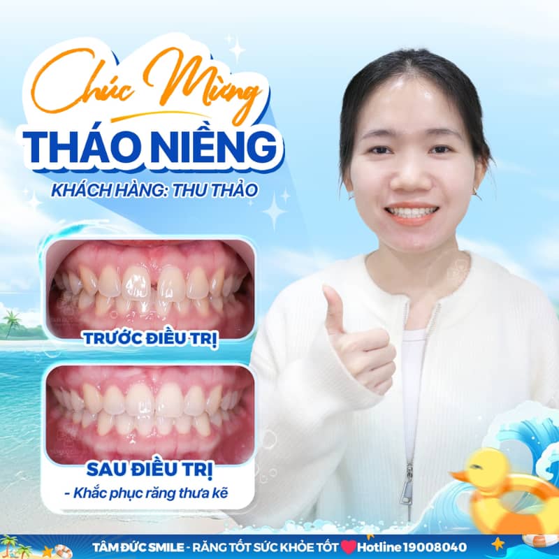 ABC8 được thành lập vào năm 2011 hoạt động đến hiện tại mắc cài kim loại hiệu quả cao cho tuổi 20