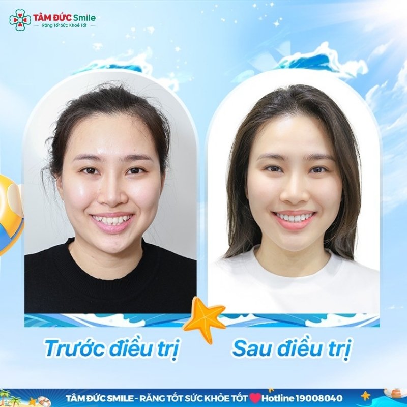 ABC8 được thành lập vào năm 2011 hoạt động đến hiện tại giúp Quý khách trở nên tự tin hơn