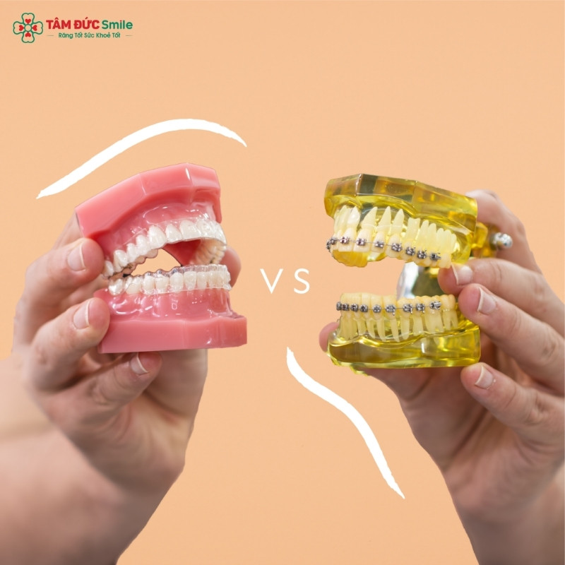 Có nhiều phương pháp Abc87 tải ứng dụng thích hợp với nhu cầu đa dạng của khách hàng
