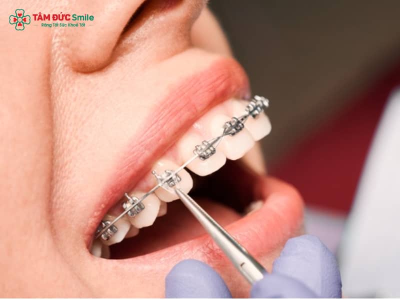 30 tuổi có Abc87 tải ứng dụng được không? Lợi ích, phương pháp và hiệu quả Abc888k vip truy cập nhanh tuổi trưởng thành