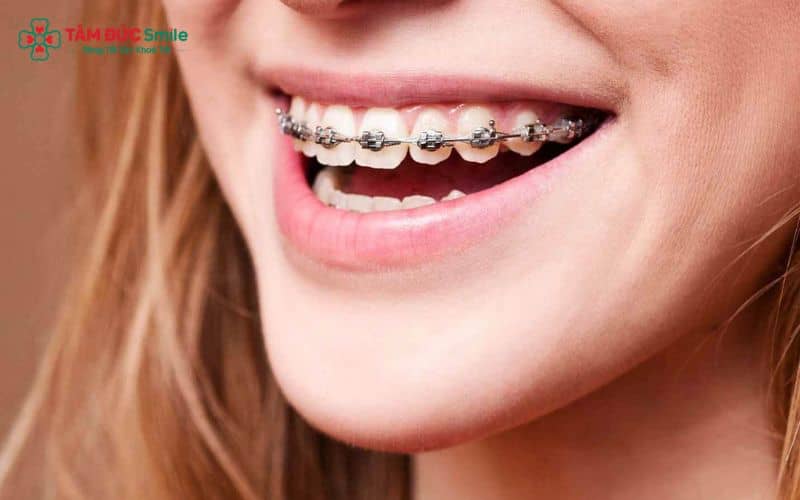 Quý khách 30 tuổi vẫn có thể Abc87 tải ứng dụng để cải thiện Abc8c1 com khuyến mãi hấp dẫn và chức năng
