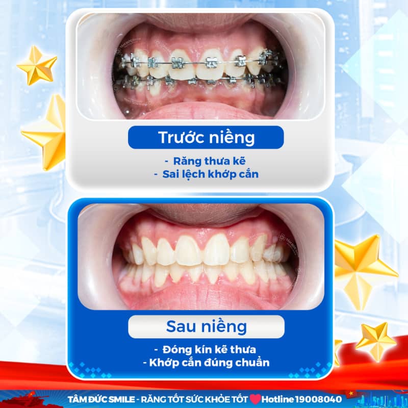 ABC8 được thành lập vào năm 2011 hoạt động đến hiện tại mắc cài kim loại mang lại hiệu quả Abc888k vip truy cập nhanh tối ưu ở tuổi 30