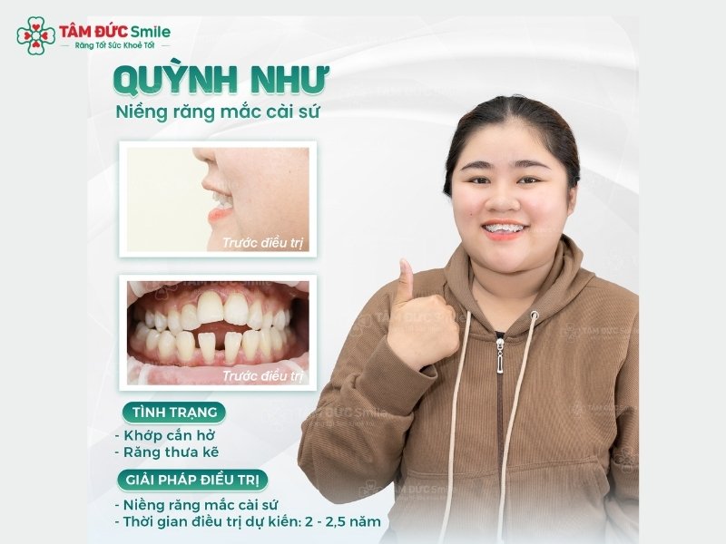 33-tuoi-co-nen-nieng-rang-5