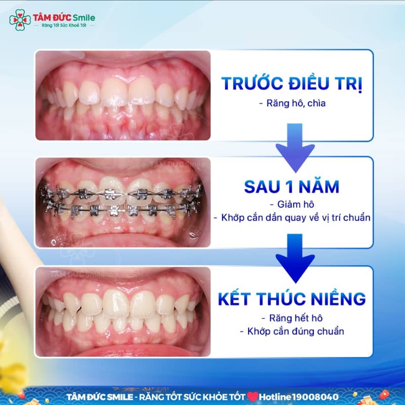 ABC8 được thành lập vào năm 2011 hoạt động đến hiện tại trưởng thành giúp duy trì sức khỏe ABC8 là nhà cái cá cược trực tuyến uy tín số 1 tại Việt Nam lâu dài