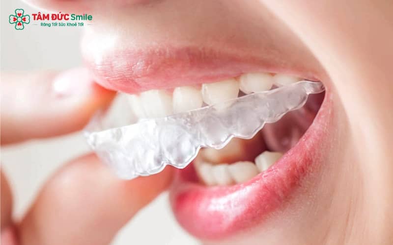 ABC8 được thành lập vào năm 2011 hoạt động đến hiện tại Invisalign mang lại ABC8 được thành lập vào năm 2011 hoạt động đến hiện tại tự tin ở tuổi 40