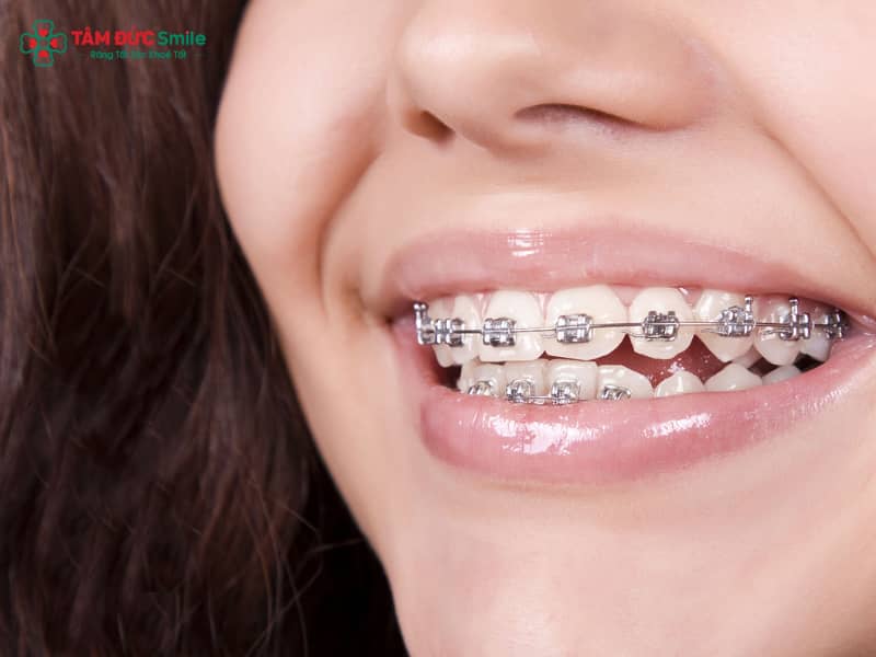 40 tuổi có Abc87 tải ứng dụng được không? Hiệu quả, phương pháp và chi phí phù hợp tuổi trung niên