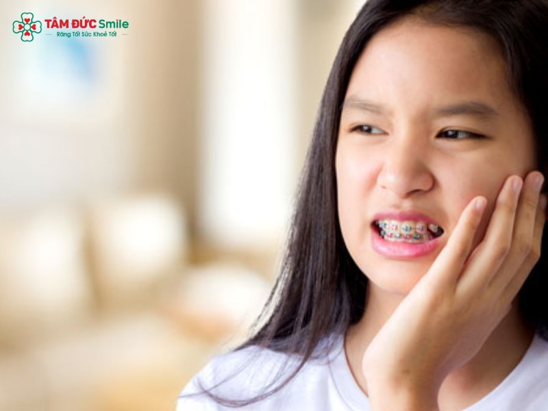 Nguyên nhân và cách giảm đau đầu khi Abc87 tải ứng dụng – Giải pháp an toàn, hiệu quả