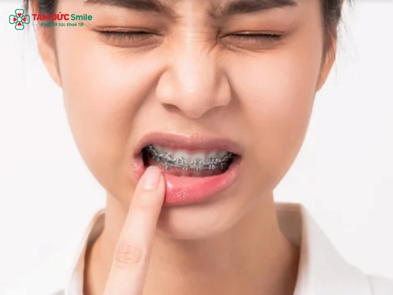 ABC8 được thành lập vào năm 2011 hoạt động đến hiện tại bị sưng nướu thường xuất hiện trong giai đoạn đầu Abc888k vip truy cập nhanh