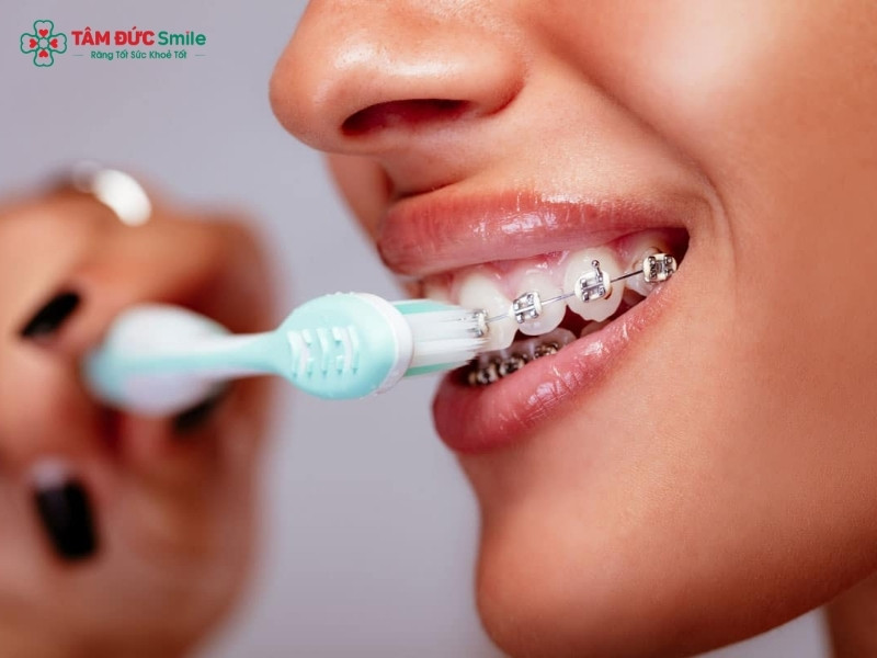 Vệ sinh ABC8 là nhà cái cá cược trực tuyến uy tín số 1 tại Việt Nam đúng cách là cách phòng ngừa sưng nướu khi Abc87 tải ứng dụng hiệu quả