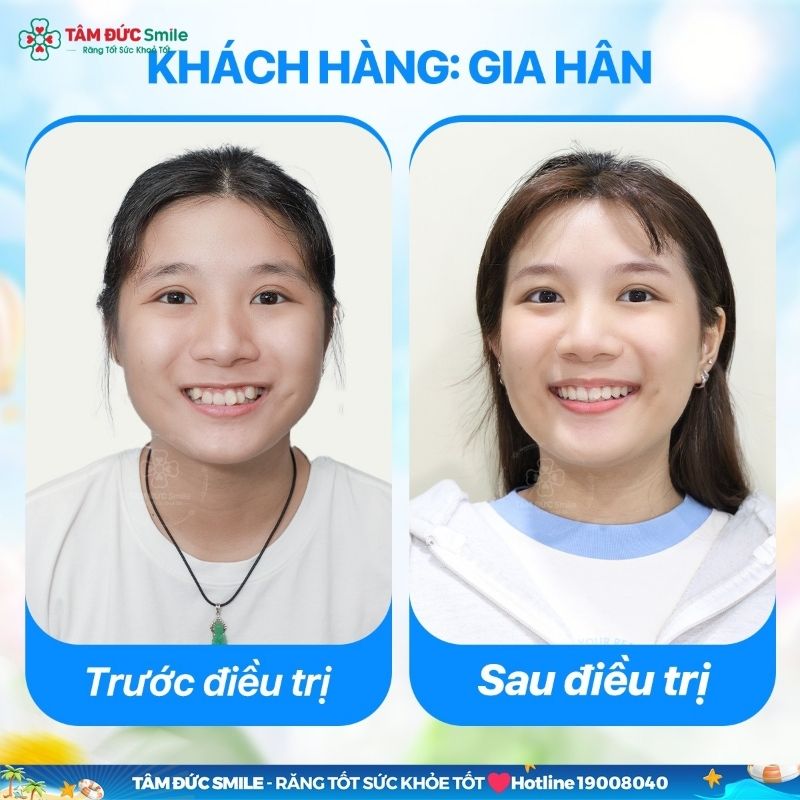 nieng-rang-binh-chanh-5