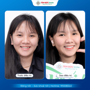 nieng-rang-ca-mau-1