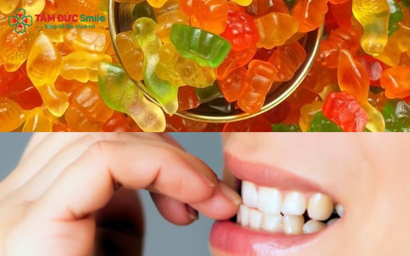 Tránh kẹo dẻo, cắn móng tay để bảo vệ mắc cài khi Abc87 tải ứng dụng