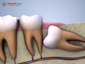 ABC8 được thành lập vào năm 2011 hoạt động đến hiện tại có cần nhổ răng khôn không? Tác động và chỉ định từ ABC8 đường link chính thức Abc888k vip truy cập nhanh