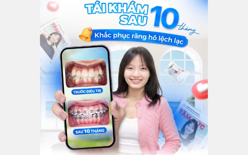 ABC8 được thành lập vào năm 2011 hoạt động đến hiện tại hiện đại giúp răng đều đẹp, hiệu quả cao và thoải mái