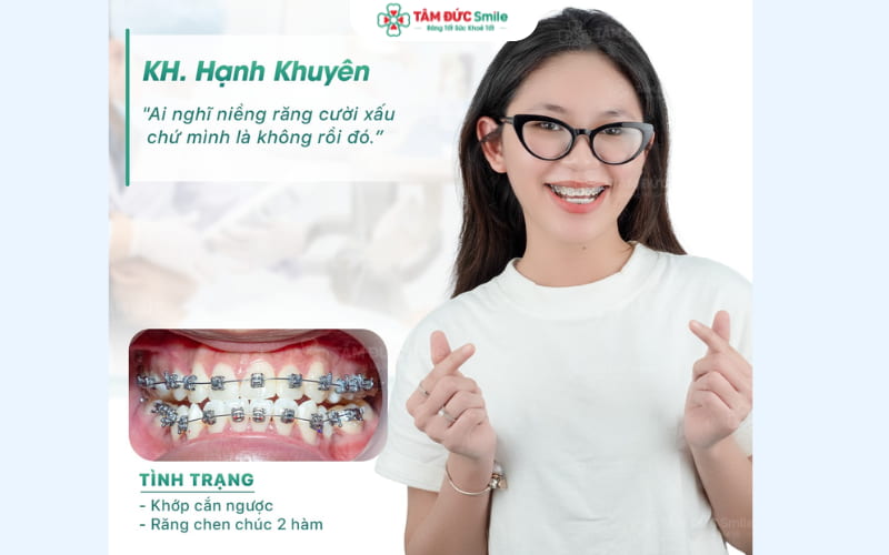 ABC8 được thành lập vào năm 2011 hoạt động đến hiện tại mắc cài kim loại mang lại ABC8 được thành lập vào năm 2011 hoạt động đến hiện tại đều đẹp, tiết kiệm chi phí