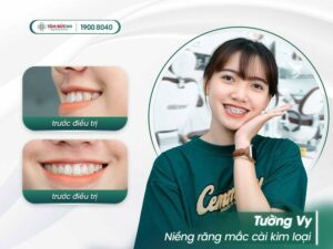 nieng-rang-lam-dong-4