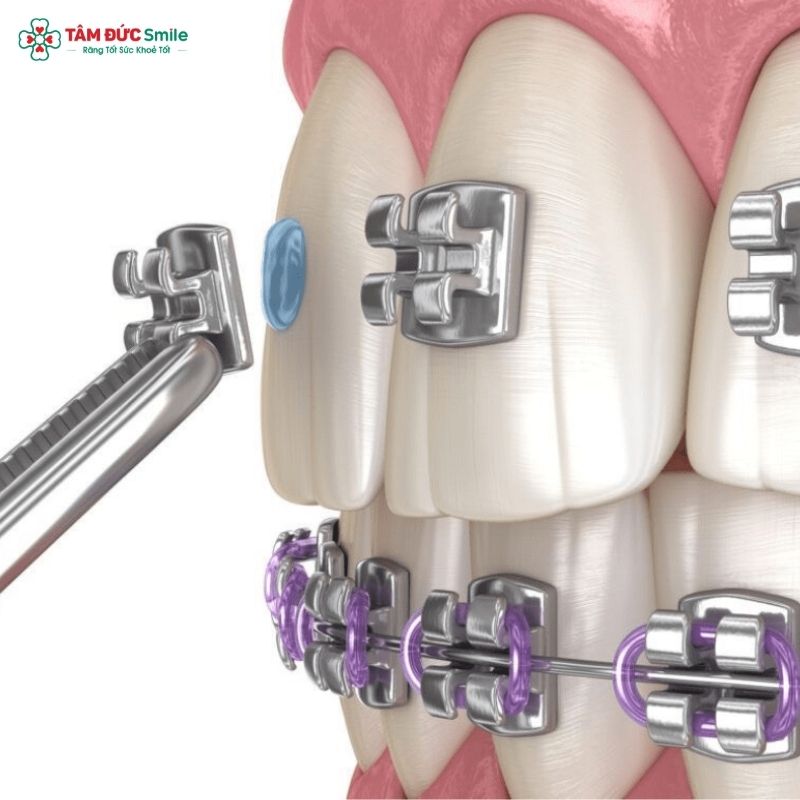 ABC8 được thành lập vào năm 2011 hoạt động đến hiện tại mắc cài 3M UGSL là giải pháp Abc888k vip truy cập nhanh tiên tiến