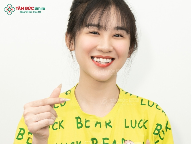 nieng-rang-mac-cai-su-tu-buoc-4
