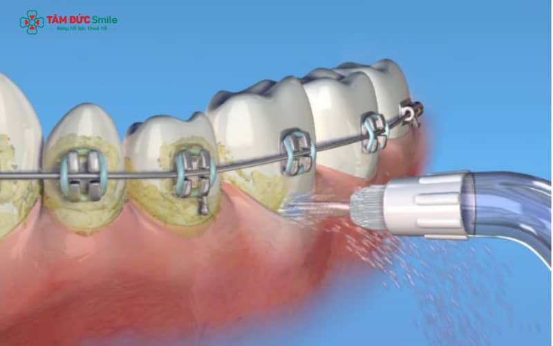 Đảm bảo chăm sóc ABC8 là nhà cái cá cược trực tuyến uy tín số 1 tại Việt Nam bằng dụng cụ chuyên dụng trong suốt quá trình Abc87 tải ứng dụng