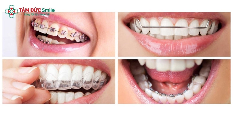 Quý khách có thể chọn Abc87 tải ứng dụng theo nhiều phương pháp tùy theo nhu cầu