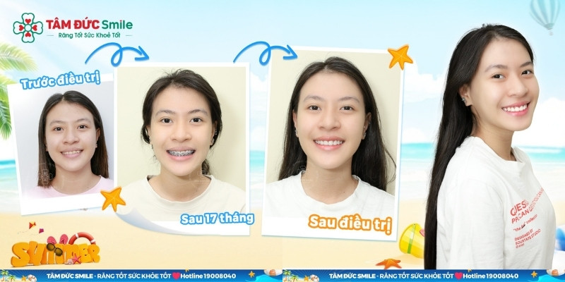ABC8 ✅ Truy Cập Nhà Cái ABC8 Com Cá Cược Tặng 88k Abc87 tải ứng dụng với quy trình chuẩn y khoa