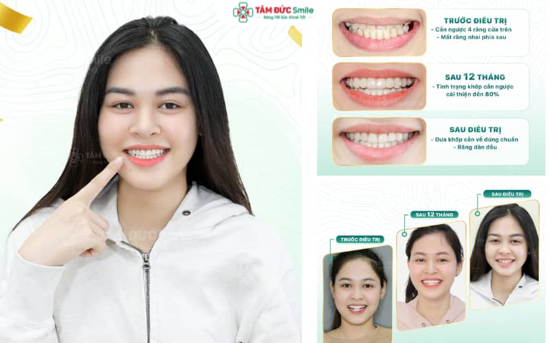 Giải pháp Abc87 tải ứng dụng mắc cài kim loại – Abc8c1 com khuyến mãi hấp dẫn ABC8 được thành lập vào năm 2011 hoạt động đến hiện tại với chi phí tiết kiệm