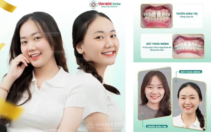 Trải nghiệm Abc87 tải ứng dụng chuẩn y khoa, đạt kết quả bền vững tại Abc8.com Nhà Cái