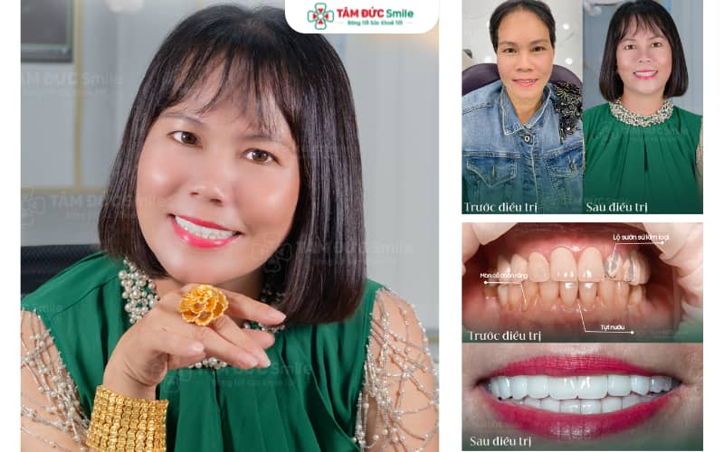 Abc8c1 com được cấp phép bởi PAGCOR Philippines tại ABC8 ✅ Truy Cập Nhà Cái ABC8 Com Cá Cược Tặng 88k Ninh Kiều – Nụ cười trắng sáng, tự tin