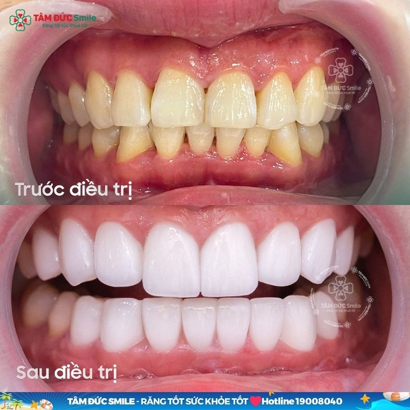 Abc8c1 com được cấp phép bởi PAGCOR Philippines giúp cải thiện Abc8c1 com khuyến mãi hấp dẫn và khả năng ăn nhai