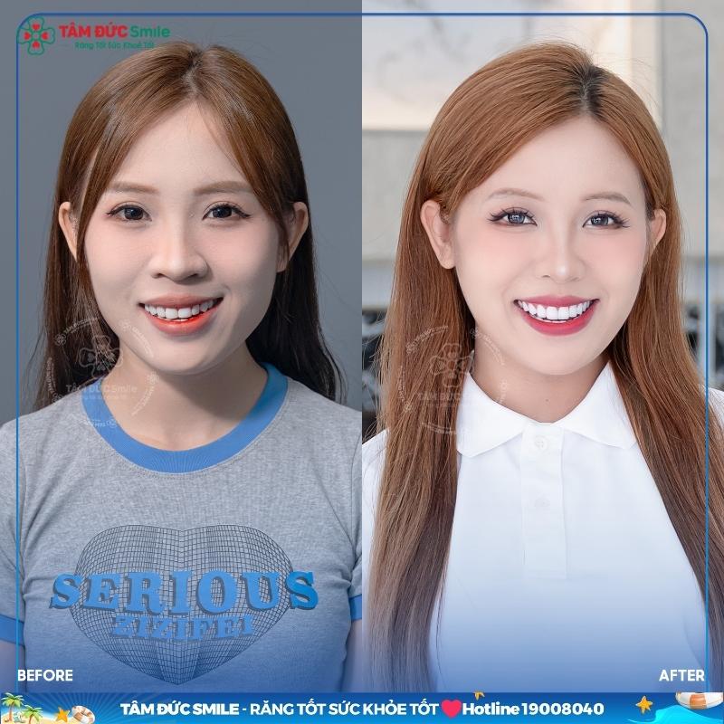 ABC8 ✅ Truy Cập Nhà Cái ABC8 Com Cá Cược Tặng 88k áp dụng quy trình Abc8.com Thể thao, Đá gà, Xổ số, Bắn cá chuẩn y khoa