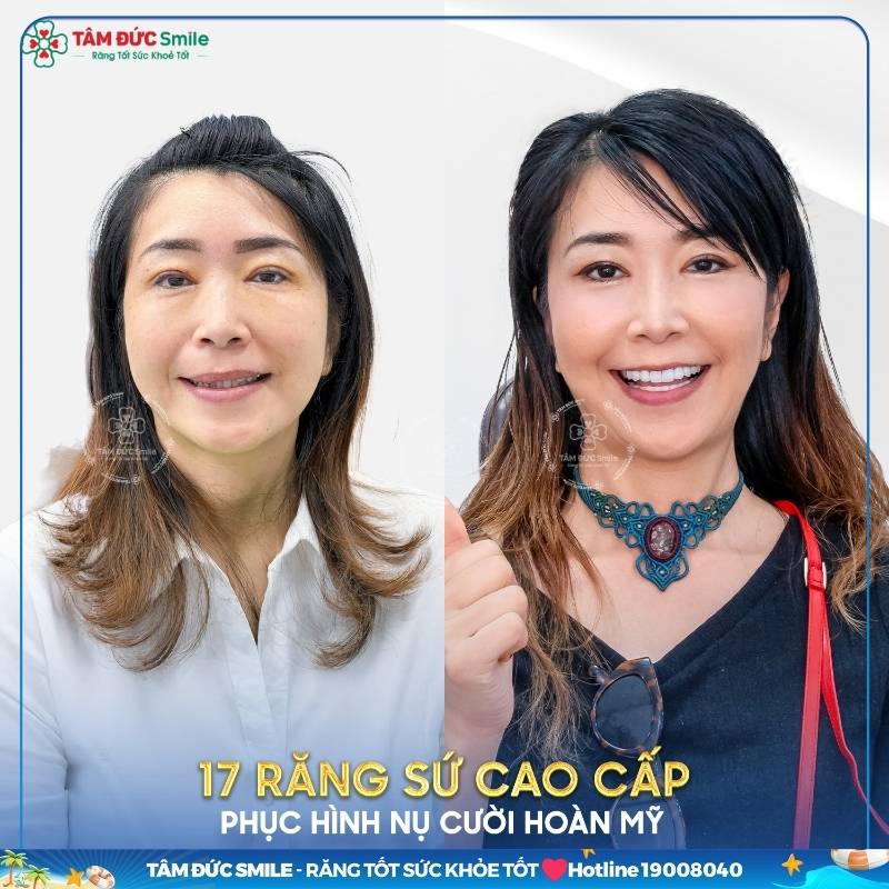 Hình ảnh thực tế của khách hàng trước và sau khi Abc8.com Thể thao, Đá gà, Xổ số, Bắn cá tại ABC8 ✅ Truy Cập Nhà Cái ABC8 Com Cá Cược Tặng 88k