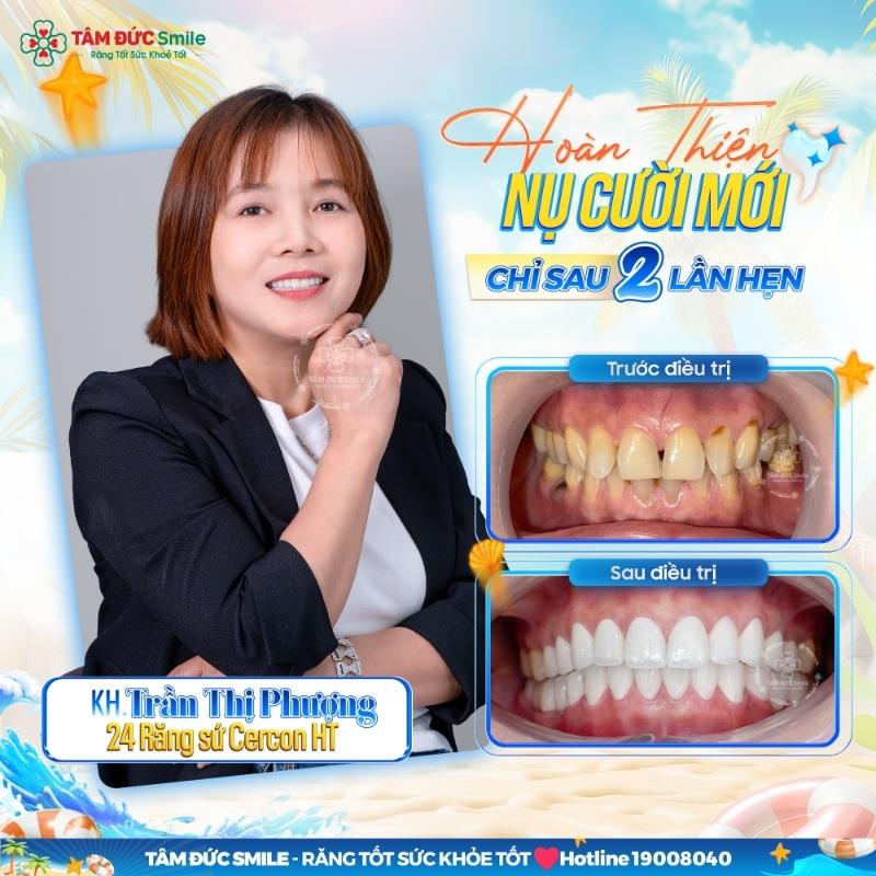 Hình ảnh thực tế của khách hàng trước và sau khi Abc8.com Thể thao, Đá gà, Xổ số, Bắn cá tại ABC8 ✅ Truy Cập Nhà Cái ABC8 Com Cá Cược Tặng 88k