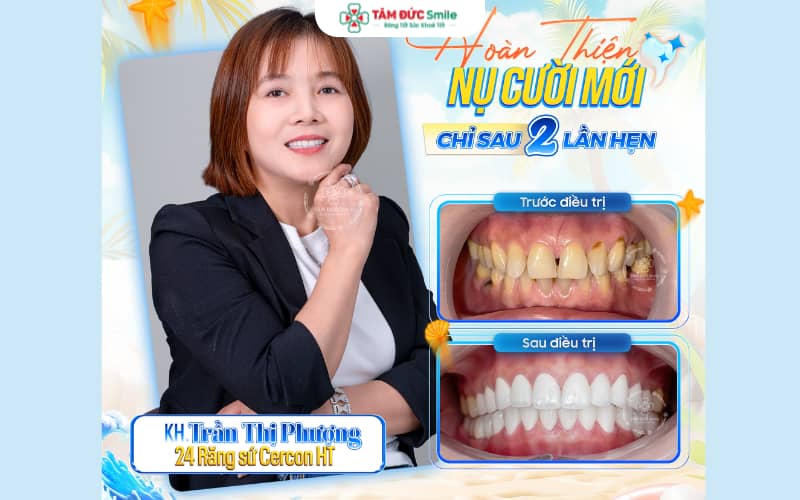 Dòng ABC8 là nhà cái cá cược trực tuyến uy tín số 1 tại Việt Nam Zirconia nổi bật với độ bền chắc cao, chịu lực lên đến 1200 MPa