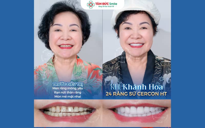ABC8 ✅ Truy Cập Nhà Cái ABC8 Com Cá Cược Tặng 88k mang đến ABC8 là nhà cái cá cược trực tuyến uy tín số 1 tại Việt Nam trắng sáng, hài hòa tự nhiên